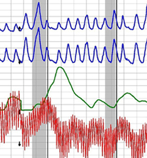 Los Angeles polygraph